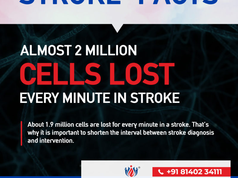 STROKE_FACTS